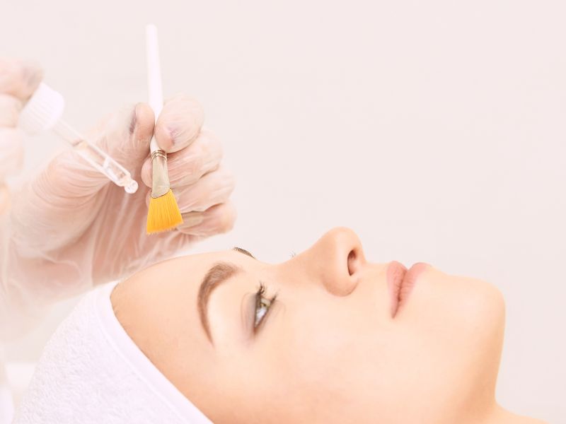 Salicylic-Peel-los-angeles-the-skin-clinic